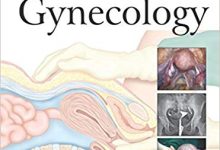 Dc Dutta Textbook of Gynaecology pdf