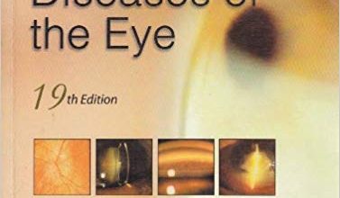 Parsons Diseases of the Eye pdf